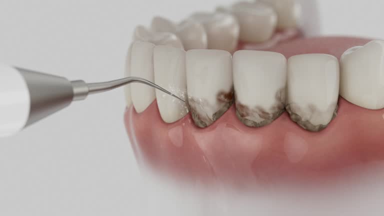 Trusted Emergency Dentist service in Trappe, MD - Dentist Open Now